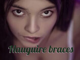 Nauguire_braces